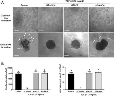 Characterization of the roles of amphiregulin and transforming growth factor β1 in microvasculature-like formation in human granulosa-lutein cells